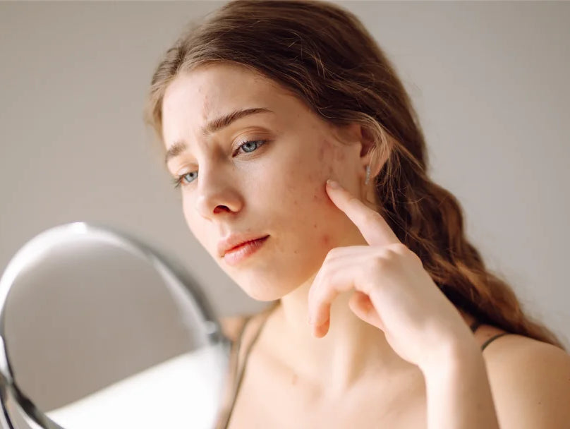 A woman gazes into a mirror, examining her face, which shows visible pimples and signs of concern